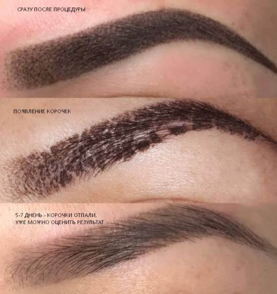 брови татуаж заживление